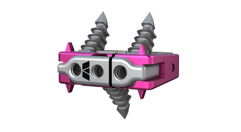 Elevation Spine Saber-C Spinal Fusion Implant