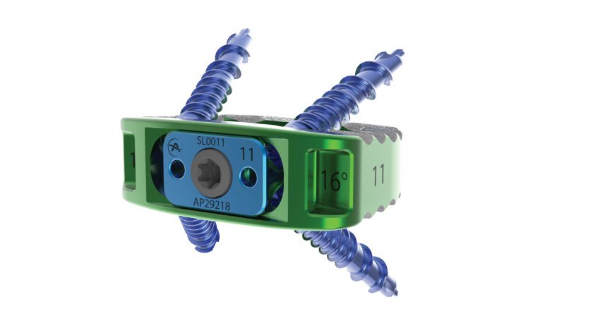 Altus Spine Indy Standalone ALIF System