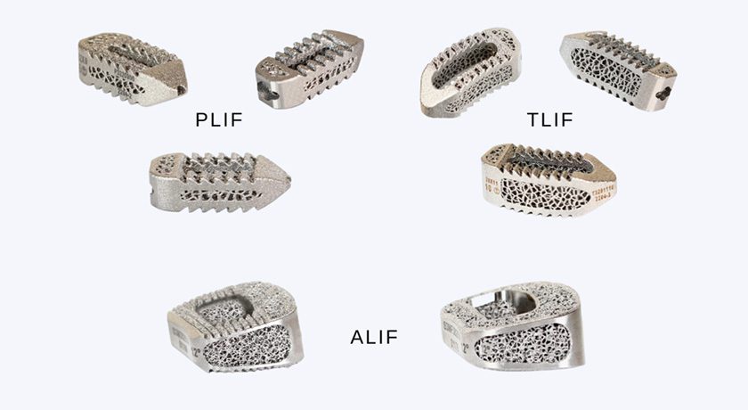 Eminent Spine 3D Titanium Lumbar Interbody Fusion Systems