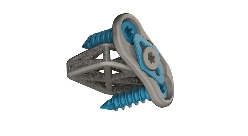 4WEB Cervical Spine Truss System