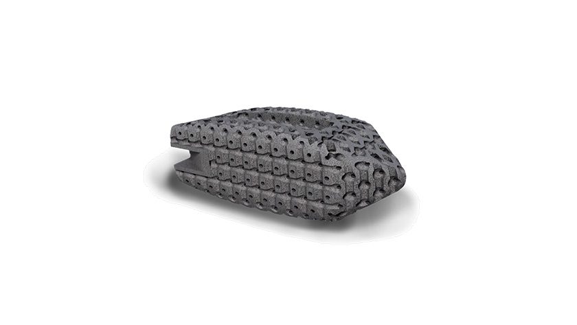 Xenix Medical neoWave Interbody Device