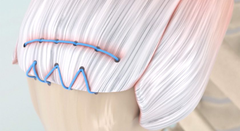 Integrity Orthopaedics Rotator Cuff Repair