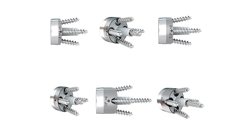 FX Shoulder Solutions Full Wedge Augmented Glenoid Baseplates