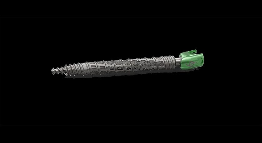 SI-BONE iFuse Bedrock Granite Implant