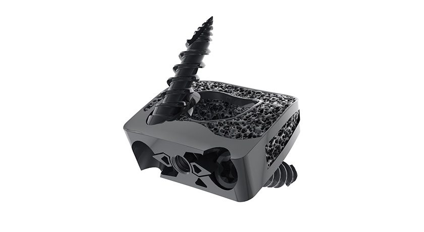 Spineart SCARLET-AC-TI Anterior Cervical Cage