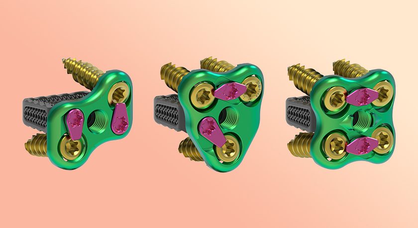 Nexxt Spine Struxxure MCS