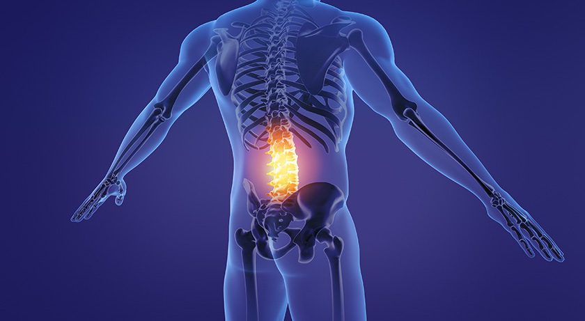 Lumbar Spine