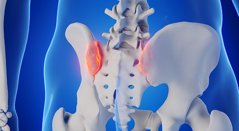 VGI Medical Announces First Successful Surgeries with SiJoin T4 Implant
