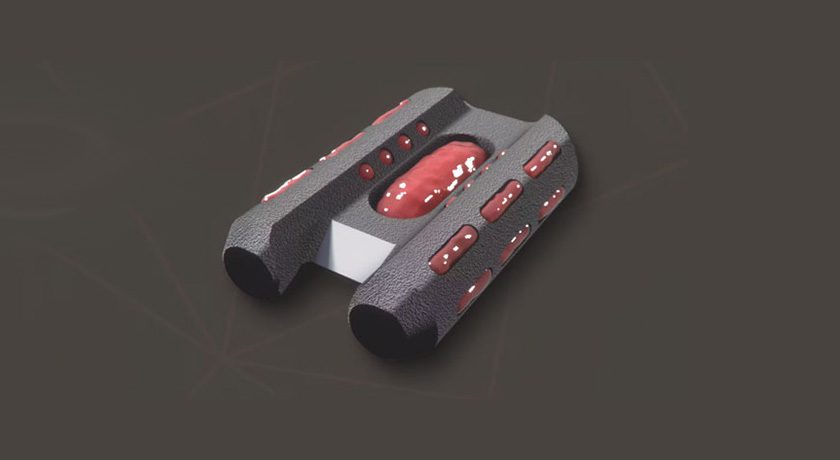 Tenon Medical Catamaran SI Joint Fusion System
