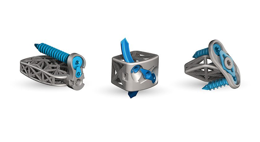 4WEB Medical Truss Implant Technology
