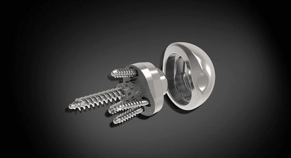 Exactech Equinoxe Central Screw Baseplate