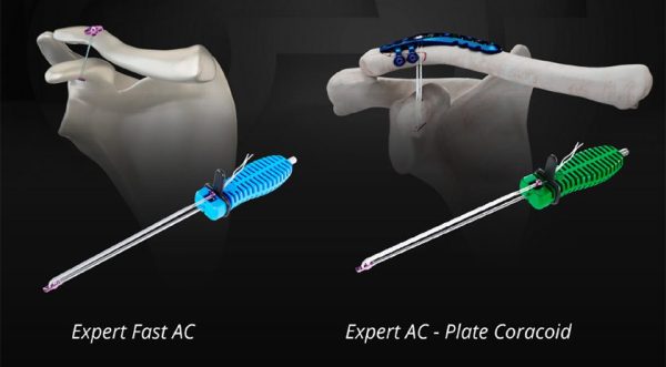 GMReis Expert AC Fixation