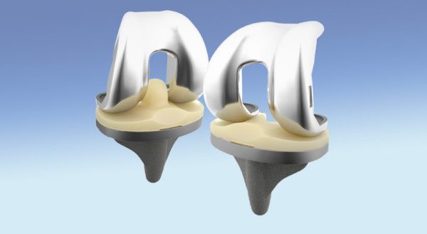 b-One MOBIO Knee Implants